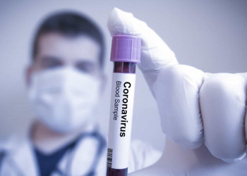 Pesquisadores descobrem remédio com 94% de eficácia contra coronavírus